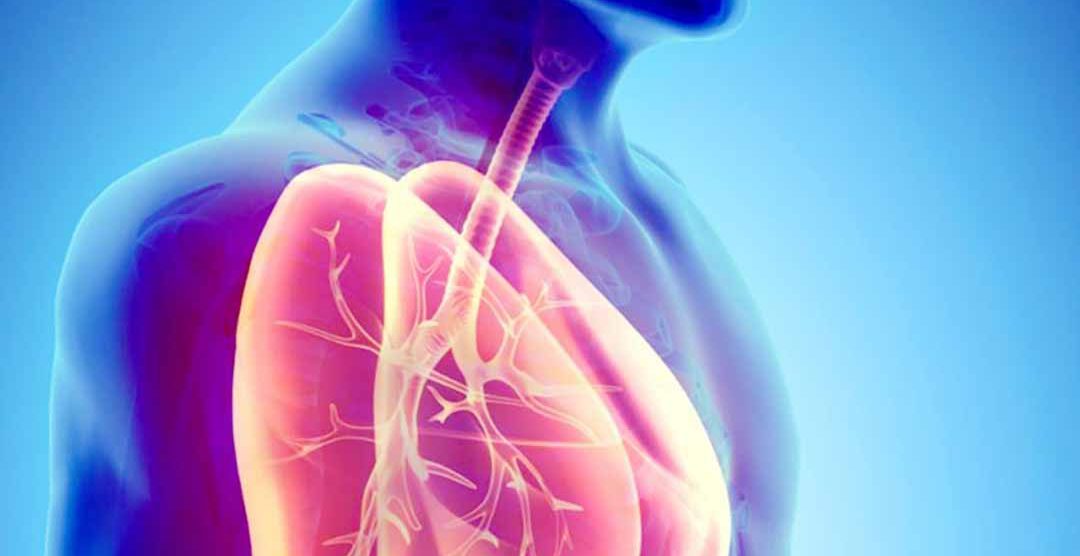 Viêm đường hô hấp dưới: Nguyên nhân, triệu chứng, chẩn đoán và điều trị